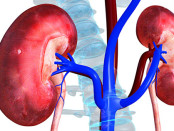 share-kidney-failure